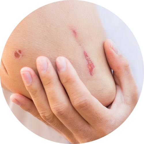 Fakty i mity na temat ran